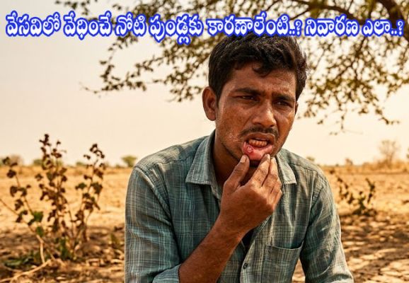 Mouth Ulcers in Summer : వేసవిలో వేధించే నోటి పుండ్లకు కారణాలేంటి..? నివారణ ఎలా..?