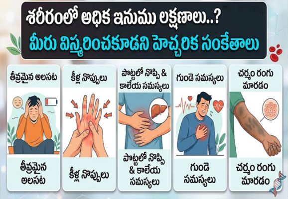 Symptoms of Excess Iron : శరీరంలో ఐరన్ ఎక్కువైతే ఎలాంటి లక్షణాలు కనిపిస్తాయి..?