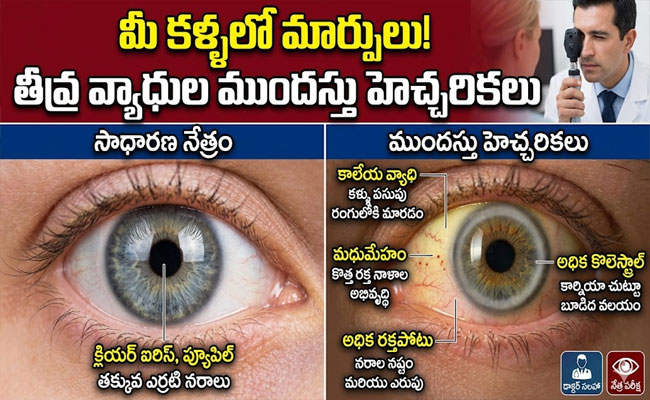 Eyes Warning Signs : మీ కళ్లల్లో ఈ మార్పులు కనిపిస్తే తీవ్రమైన వ్యాధులకు ముందస్తు హెచ్చరికలు కావచ్చు..!