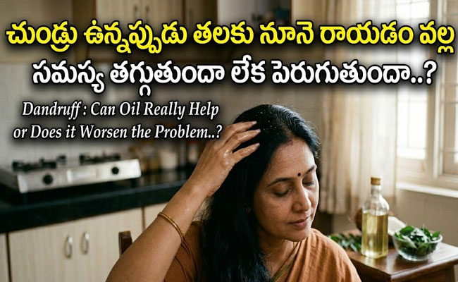 Dandruff : చుండ్రు ఉన్నప్పుడు తలకు నూనె రాయడం వల్ల సమస్య తగ్గుతుందా లేక పెరుగుతుందా..? 