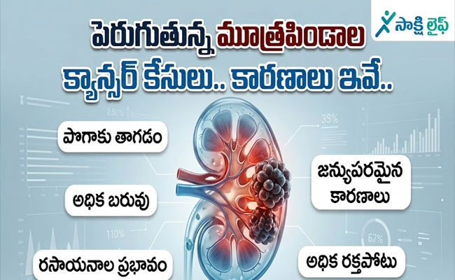Rising Kidney Cancer Cases :పెరుగుతున్న మూత్రపిండాల క్యాన్సర్ కేసులు.. కారణాలు ఇవే.. 
