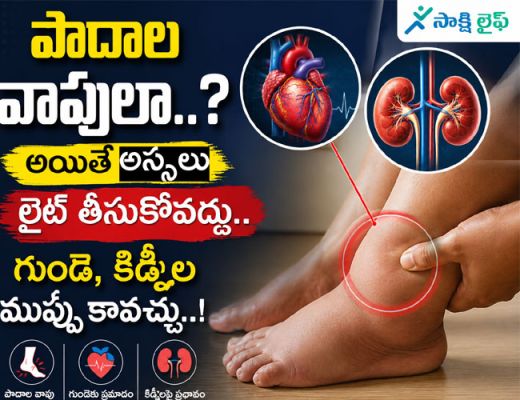 Swollen Feet : పాదాల వాపులా..? అయితే అస్సలు లైట్ తీసుకోవద్దు.. గుండె, కిడ్నీల ముప్పు కావచ్చు..!