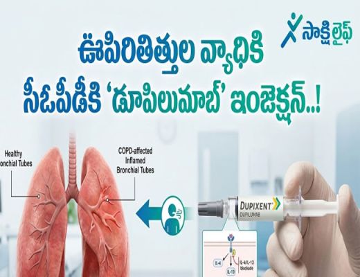 Lung Disease : ఊపిరితిత్తుల వ్యాధికి సీఓపీడీకి 'డూపిలుమాబ్' ఇంజెక్షన్..!