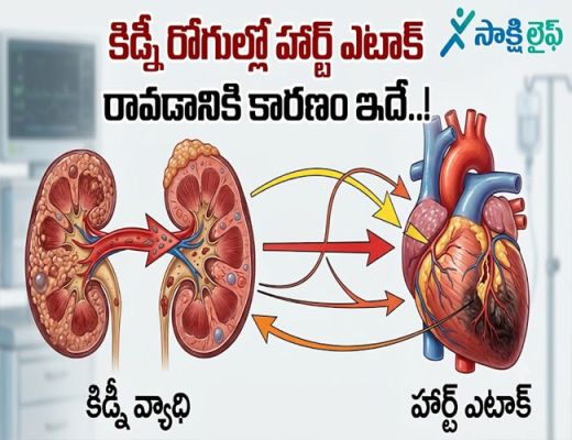 Heart Attack- Kidney : కిడ్నీ రోగుల్లో హార్ట్ ఎటాక్ రావడానికి కారణం ఇదే..!