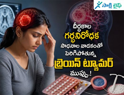 Brain Tumor Risk : దీర్ఘకాల గర్భనిరోధక సాధనాల వాడకంతో మహిళల్లో పెరిగిపోతున్న బ్రెయిన్ ట్యూమర్ ముప్పు..!