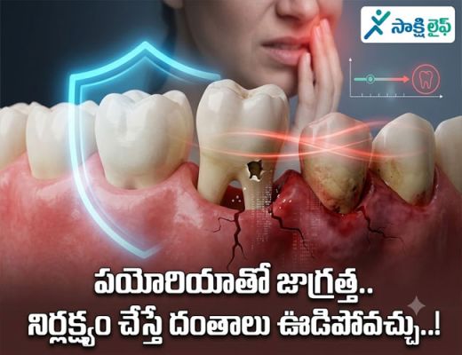 Dental problems : పయోరియాతో జాగ్రత్త.. నిర్లక్ష్యం చేస్తే దంతాలు ఊడిపోవచ్చు..!