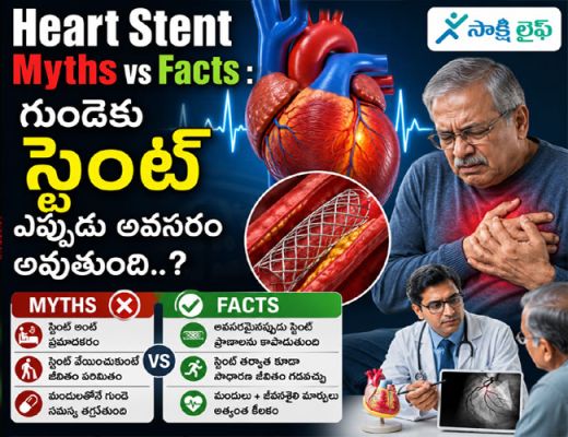 Heart Stent Myths vs Facts : గుండెకు స్టెంట్ ఎప్పుడు అవసరం అవుతుంది..?