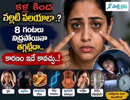 Dark Circles Under Your Eyes : కళ్ల కింద నల్లటి వలయాలా..? 8 గంటలు నిద్రపోయినా తగ్గట్లేదా.. కారణం ఇదే కావచ్చు..!