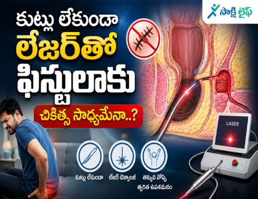 Fistula : కుట్లు లేకుండా లేజర్‌తో ఫిస్టులాకు చికిత్స సాధ్యమేనా..?  