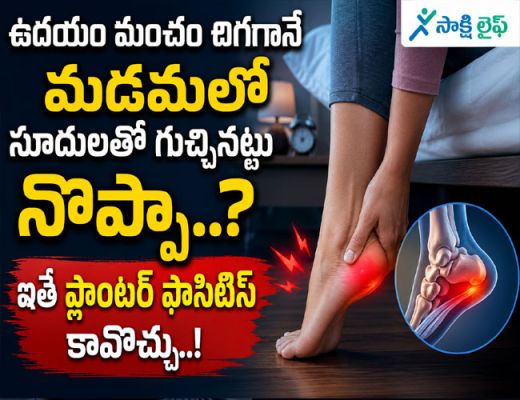 Plantar Fasciitis : ఉదయం మంచం దిగగానే మడమలో సూదులతో గుచ్చినట్టు నొప్పా..? ఐతే ప్లాంటర్ ఫాసిటిస్ కావొచ్చు..!