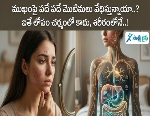 Pimples : ముఖంపై పదే పదే మొటిమలు వేధిస్తున్నాయా..? ఐతే లోపం చర్మంలో కాదు, శరీరంలోనే..!