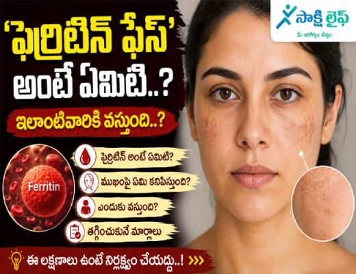 Ferritin Face : 'ఫెర్రిటిన్ ఫేస్' అంటే ఏమిటి..? ఎలాంటివారికి వస్తుంది..?
