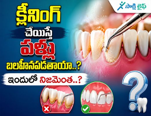 Dental problems : క్లీనింగ్ చేయిస్తే పళ్లు బలహీనపడతాయా..? ఇందులో నిజమెంత..?
