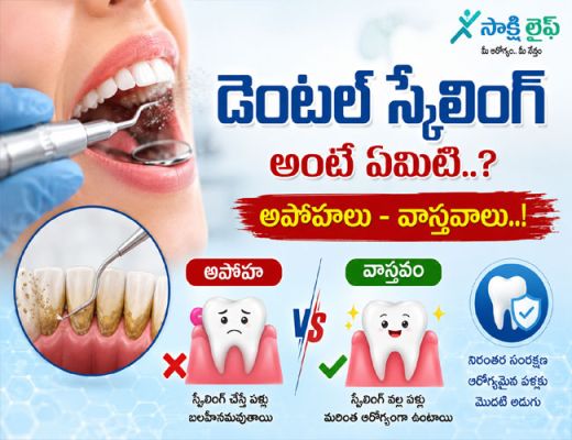 Dental Scaling : డెంటల్ స్కేలింగ్ అంటే ఏమిటి..? అపోహలు - వాస్తవాలు..!