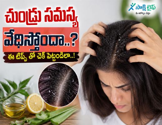 Dandruff Control : చుండ్రు సమస్య వేధిస్తోందా..? ఈ టిప్స్ తో చెక్ పెట్టండిలా..!