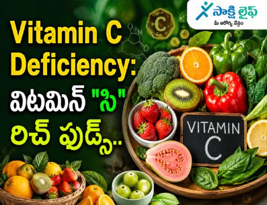 Vitamin C Deficiency: విటమిన్ "సి" రిచ్ ఫుడ్స్..