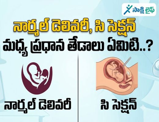 Normal Delivery vs C-Section: నార్మల్ డెలివరీ, సి సెక్షన్ మధ్య ప్రధాన తేడాలు ఏమిటి..?