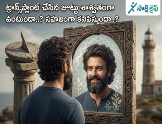 Transplanted Hair : ట్రాన్స్‌ప్లాంట్ చేసిన జుట్టు శాశ్వతంగా ఉంటుందా..? సహజంగా కనిపిస్తుందా..?