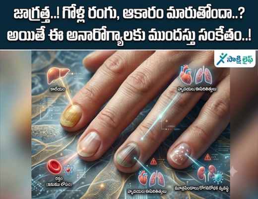 Nail Color : జాగ్రత్త..! గోళ్ల రంగు, ఆకారం మారుతోందా..? అయితే ఈ అనారోగ్యాలకు ముందస్తు సంకేతం..!