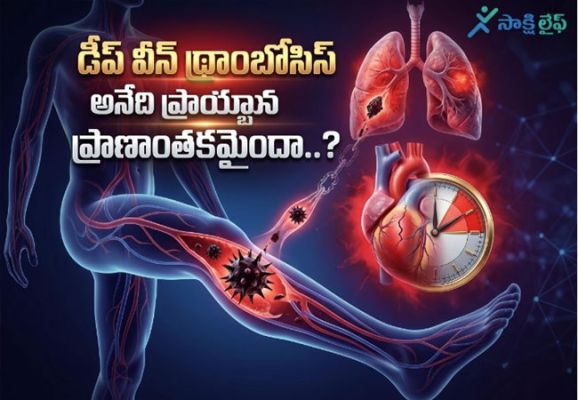 Deep Vein Thrombosis : డీప్ వీన్ థ్రాంబోసిస్ అనేది ప్రాణాంతకమైందా..?  