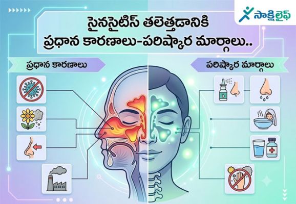 Sinusitis : సైనసైటిస్ తలెత్తడానికి ప్రధాన కారణాలు-పరిష్కార మార్గాలు.. 