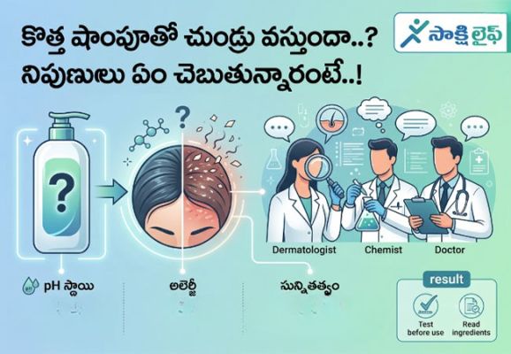 Dandruff : కొత్త షాంపూతో చుండ్రు వస్తుందా..? నిపుణులు ఏం చెబుతున్నారంటే..!