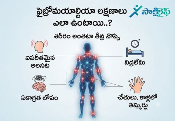 Fibromyalgia : ఫైబ్రోమయాల్జియా లక్షణాలు ఎలా ఉంటాయి..?
