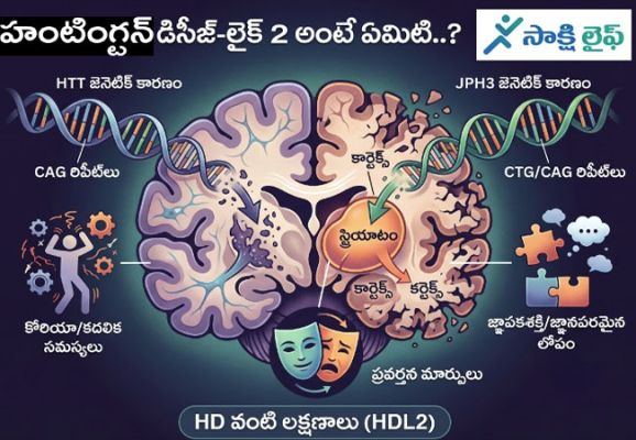 HDL2 : హంటింగ్టన్ డిసీజ్-లైక్ 2 అంటే ఏమిటి..? 