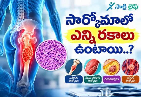Types of Sarcoma : సార్కోమాలో ఎన్ని రకాలు ఉంటాయి..? 