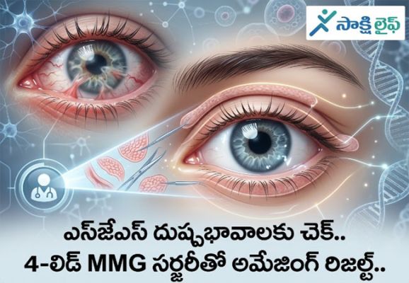 SJS Side Effects Under Control : ఎస్జేఎస్ దుష్ప్రభావాలకు చెక్.. 4-లిడ్ MMG సర్జరీతో అమేజింగ్ రిజల్ట్..