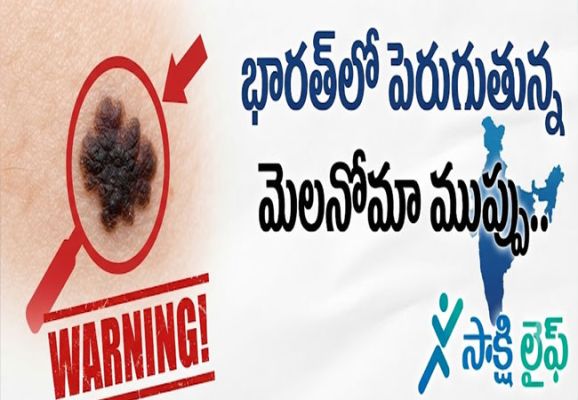 Melanoma Risk : భారత్‌లో పెరుగుతున్న మెలనోమా ముప్పు.. 