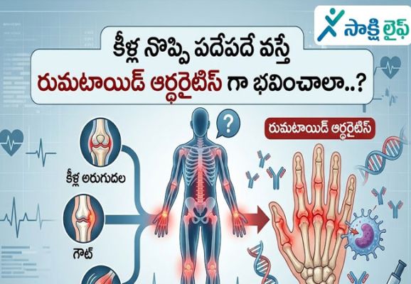 Rheumatoid Arthritis : కీళ్ల నొప్పి పదేపదే వస్తే రుమటాయిడ్ ఆర్థరైటిస్ గా భవించాలా..?