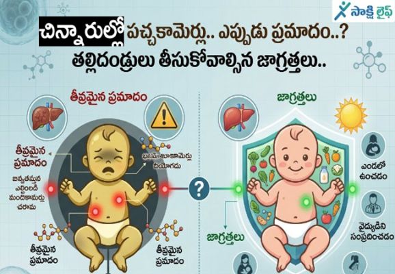 Jaundice in Children: చిన్నారుల్లో పచ్చకామెర్లు..ఎప్పుడు ప్రమాదం..? తల్లిదండ్రులు తీసుకోవాల్సిన జాగ్రత్తలు..