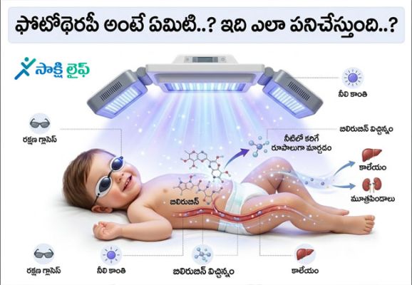 Phototherapy : ఫోటోథెరపీ అంటే ఏమిటి..? ఇది ఎలా పనిచేస్తుంది..?