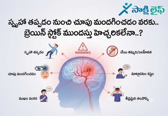 Brain Stroke : స్పృహ తప్పడం నుంచి చూపు మందగించడం వరకు.. బ్రెయిన్ స్ట్రోక్ ముందస్తు హెచ్చరికలేనా..?
