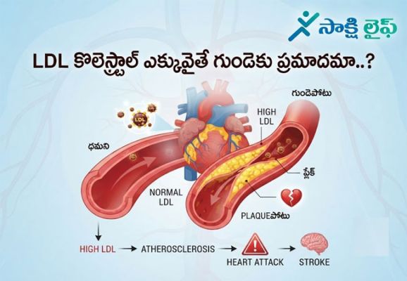 High LDL Cholesterol: LDL కొలెస్ట్రాల్ ఎక్కువైతే గుండెకు ప్రమాదమా..? 