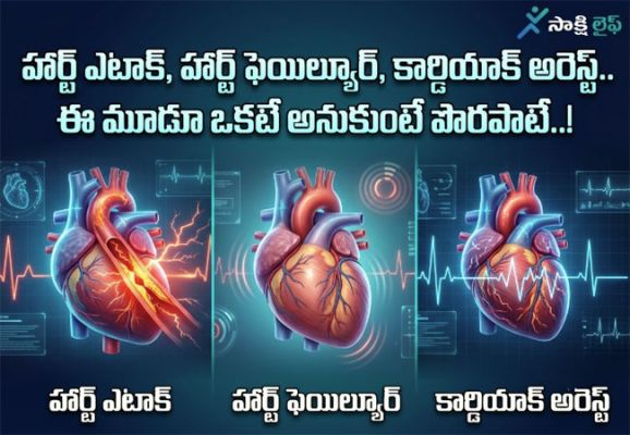 Heart Problem : హార్ట్ ఎటాక్, హార్ట్ ఫెయిల్యూర్, కార్డియాక్ అరెస్ట్.. ఈ మూడూ ఒకటే అనుకుంటే పొరపాటే..!