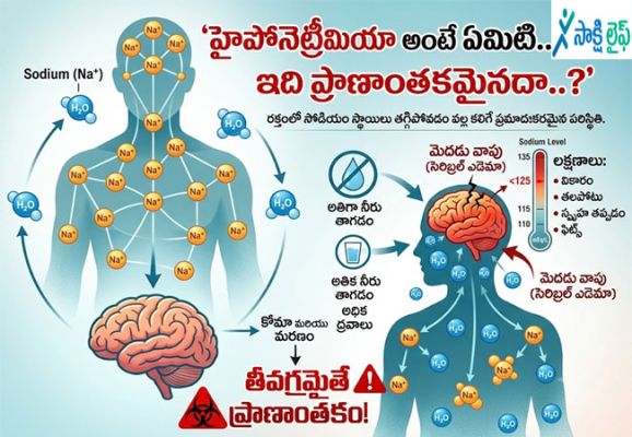 Hyponatremia : హైపోనెట్రీమియా అంటే ఏమిటి..? ఇది ప్రాణాంతకమైనదా..? 