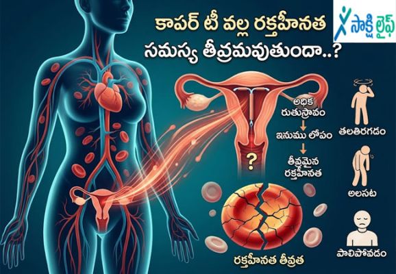 Copper-T Intrauterine Device : కాపర్ టీ వల్ల రక్తహీనత సమస్య తీవ్రమవుతుందా..?