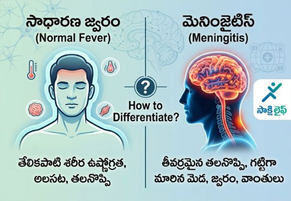 Normal Fever and Meningitis : నార్మల్ ఫీవర్ కు, మెనింజైటిస్‌కు మధ్య తేడా ఎలా గుర్తించాలి..?