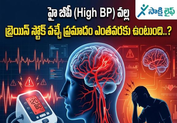 High BP : హై బీపీ వల్ల బ్రెయిన్ స్ట్రోక్ వచ్చే ప్రమాదం ఎంతవరకు ఉంటుంది..?