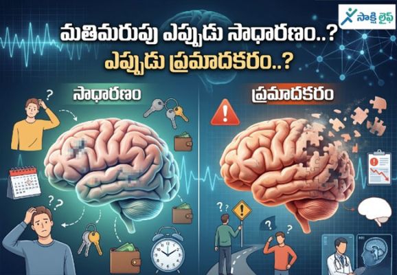 Forgetfulness : మతిమరుపు ఎప్పుడు సాధారణం..? ఎప్పుడు ప్రమాదకరం..?