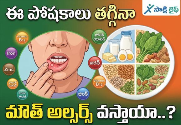 Mouth Ulcers : ఈ పోషకాలు తగ్గినా మౌత్ అల్సర్స్ వస్తాయా ..?