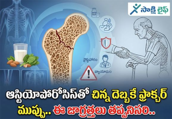 Osteoporosis : ఆస్టియోపోరోసిస్‌తో చిన్న దెబ్బకే ఫ్రాక్చర్ ముప్పు.. ఈ జాగ్రత్తలు తప్పనిసరి..