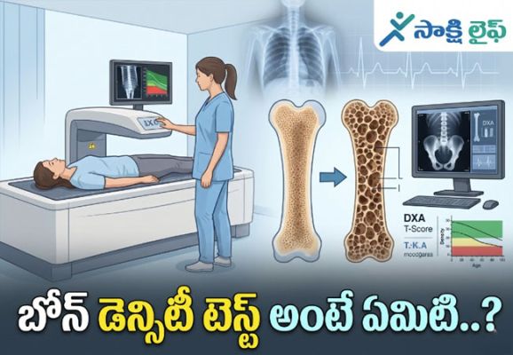 Bone Density : బోన్ డెన్సిటీ టెస్ట్ అంటే ఏమిటి..? 