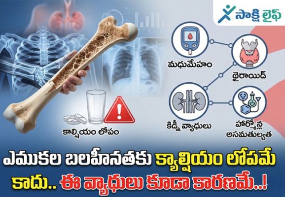 Calcium Deficiency : ఎముకల బలహీనతకు క్యాల్షియం లోపమే కాదు.. ఈ వ్యాధులు కూడా కారణమే..!