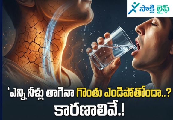 Dry Throat  and mouth : ఎన్ని నీళ్లు తాగినా గొంతు ఎండిపోతోందా..? కారణాలివే.!