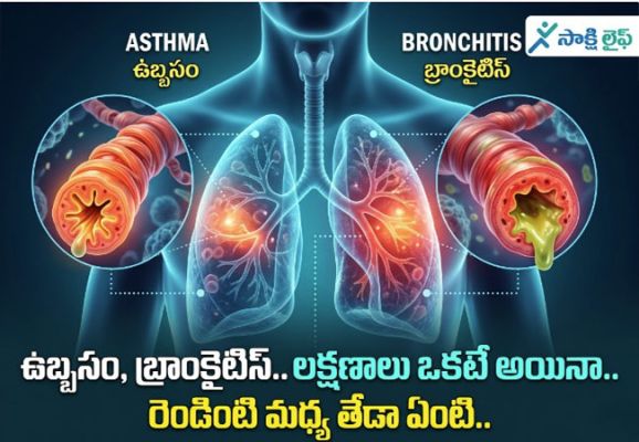 Asthma vs Bronchitis : ఉబ్బసం, బ్రాంకైటిస్..లక్షణాలు ఒకటే అయినా.. రెండింటి మధ్య తేడా ఏంటి..?