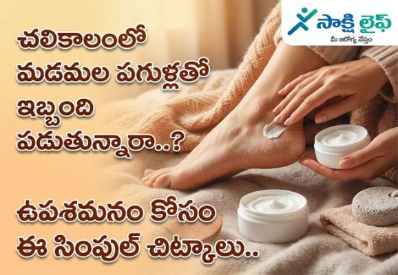 Winter care : చలికాలంలో మడమల పగుళ్లతో ఇబ్బంది పడుతున్నారా..? ఉపశమనం కోసం ఈ సింపుల్ చిట్కాలు..