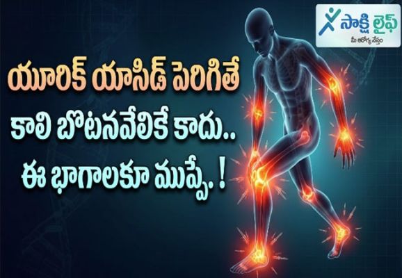 High Uric Acid : యూరిక్ యాసిడ్ పెరిగితే కాలి బొటనవేలికే కాదు.. ఈ భాగాలకూ ముప్పే..!